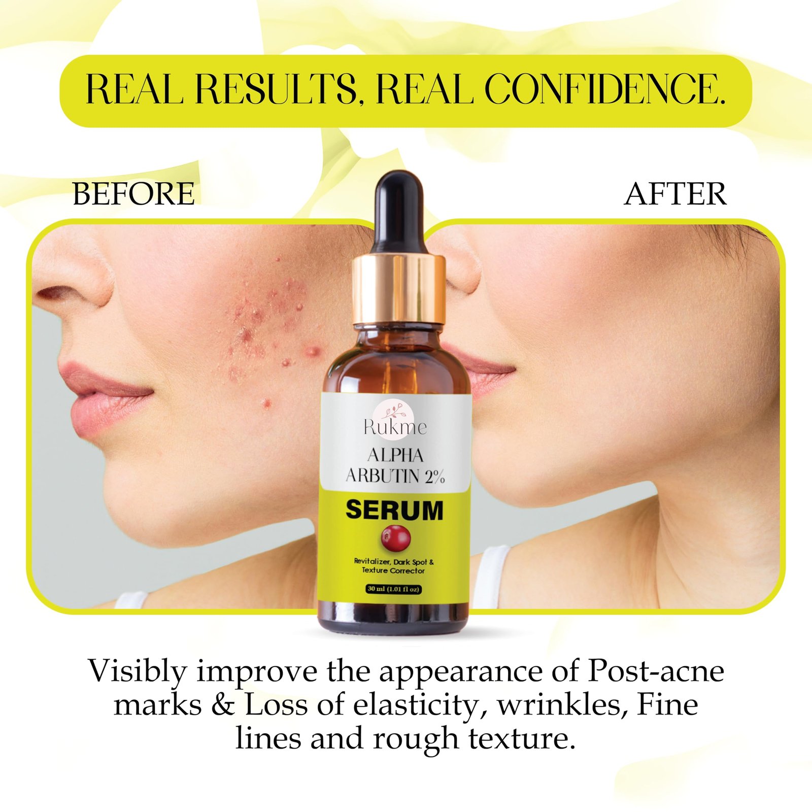 Rukme Alpha Arbutin 2% Serum, Dark Spot and Texture Corrector, Revitalizer, 30ml