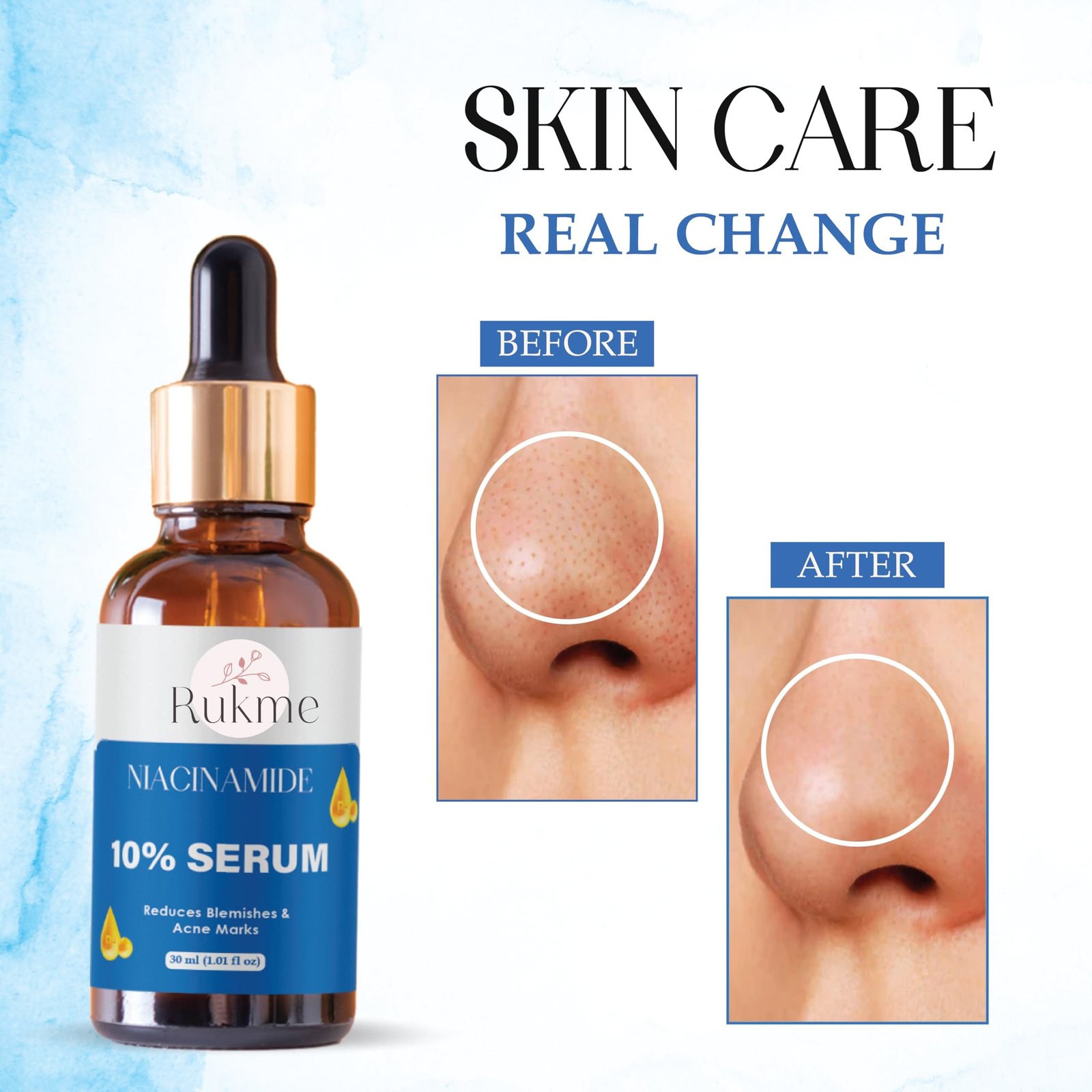 Rukme Niacinamide 10% Serum, Reduces Blemishes & Acne Marks, 30ml